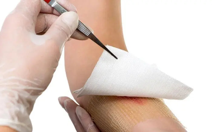 Splitterpinzette nach Feilchenfeld